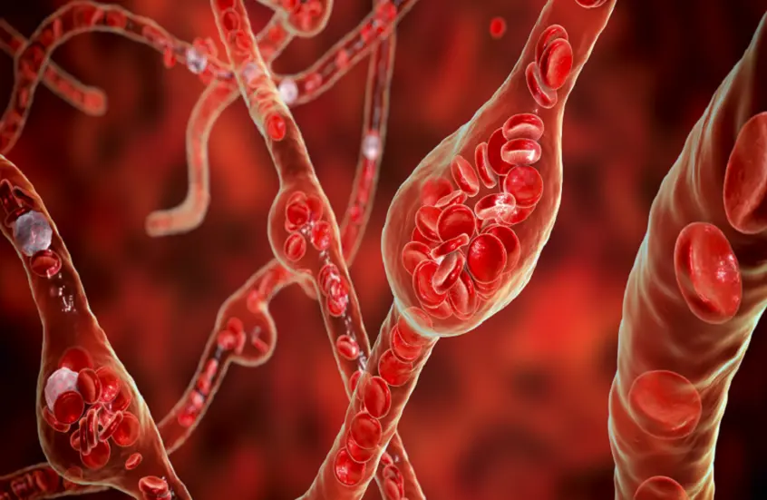 4 حقائق عن الكوليسترول لا ينبغي تجاهلها